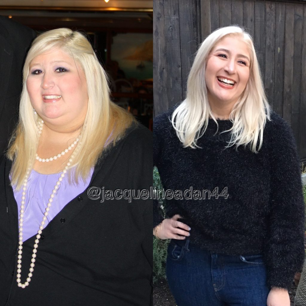 Jacqueline Before and After Weight Loss